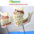 DENTAL22 (12604) Huamn Kinder Fötus Zähne Entwicklung Modell mit 4 Teilen Dental Modelle